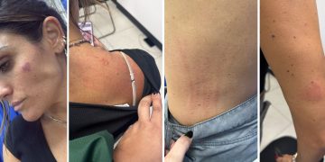 Colaboradores de Ale Rojo presentan lesiones delicadas